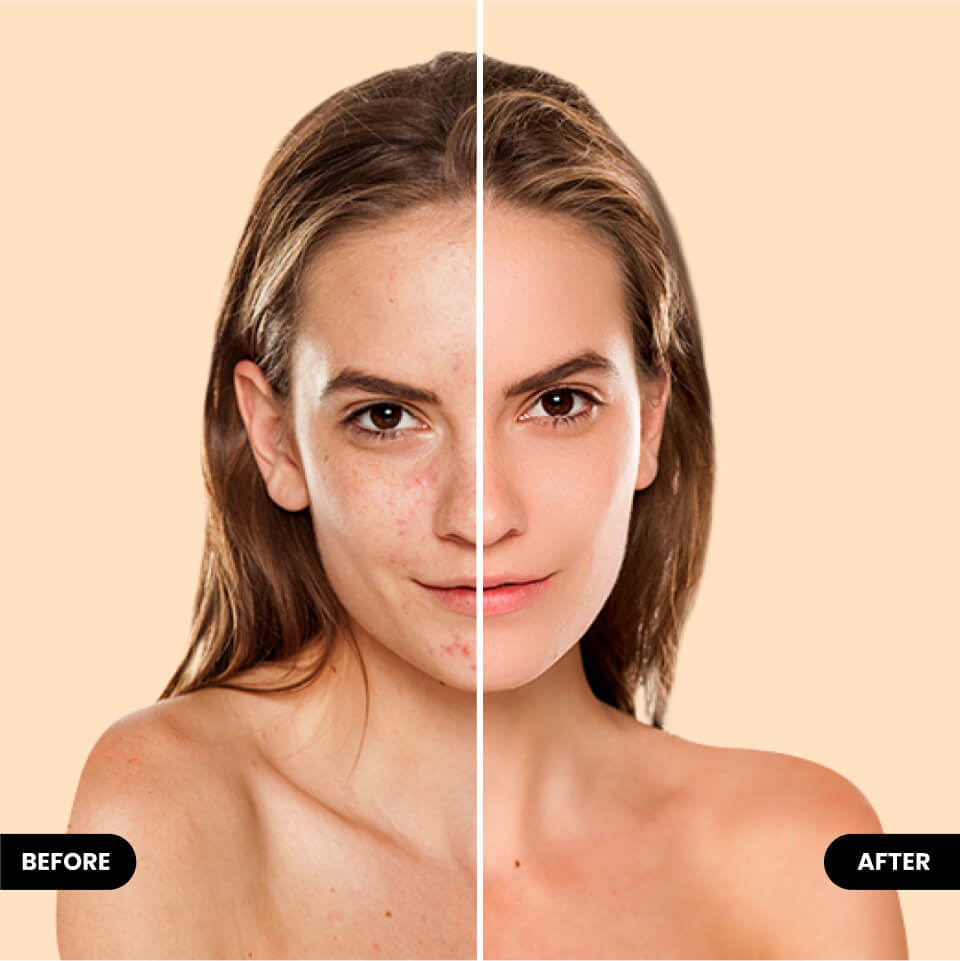 Retouch face in photo editor BeautyPlus before vs after
